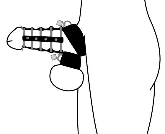 5 Ring Chastity Device with Cock and Ball Strap Image 1